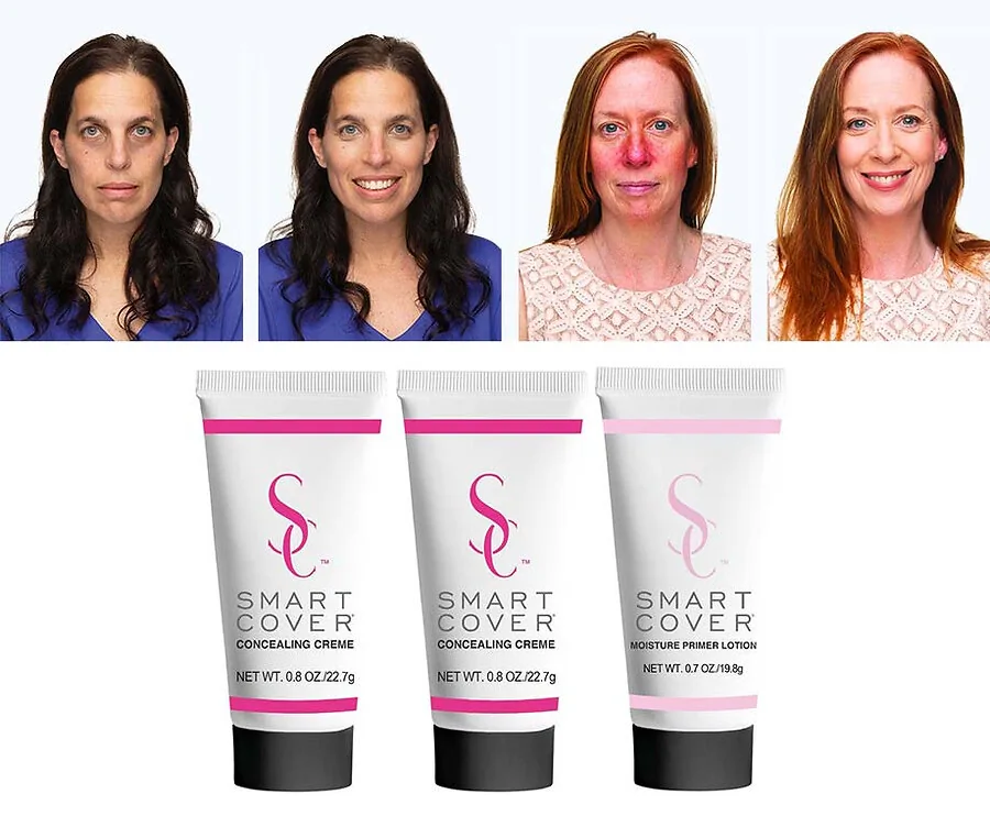 Smart Cover - Verbergt Wallen, Ouderdomsvlekken, Acne, Tattoos en Meer!