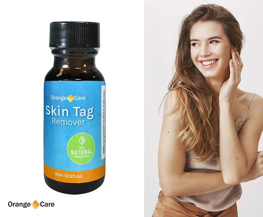 Orange Care Skin Tag Remover - Laat Fibromen Verdwijnen!